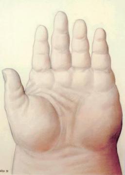 Mano Artwork by Fernando Botero